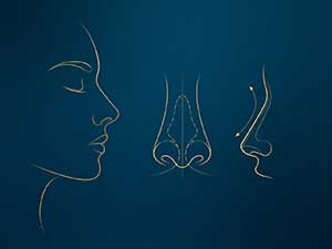 หลังจากซ่อมจมูกล้มเหลวหลายครั้งคุณสามารถซ่อมใหม่ได้หรือไม่?